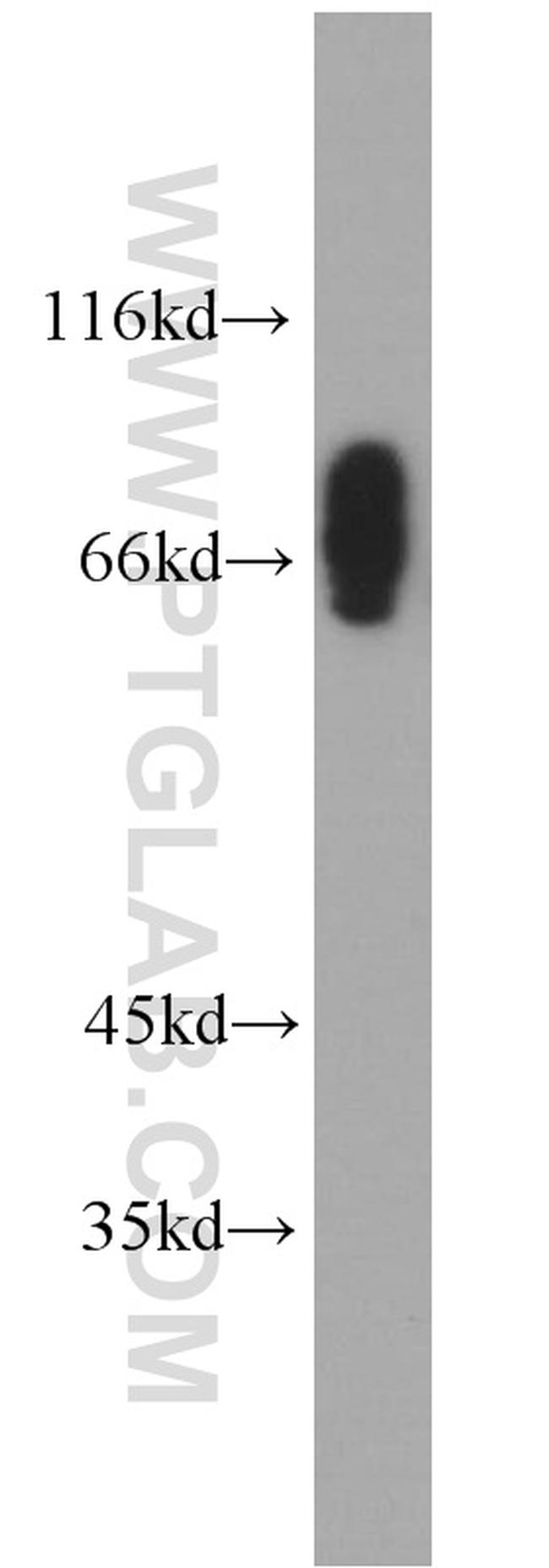 CLINT1 Antibody in Western Blot (WB)