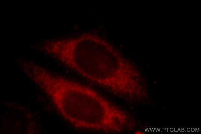 CLINT1 Antibody in Immunocytochemistry (ICC/IF)