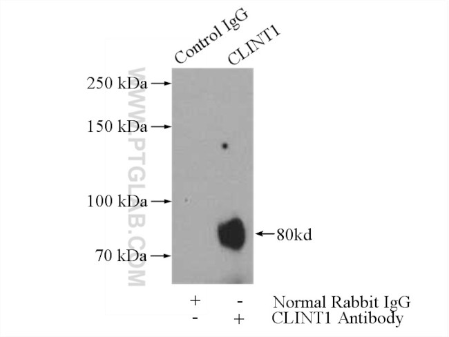 CLINT1 Antibody in Immunoprecipitation (IP)