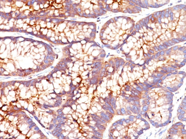 Carcinoembryonic Antigen (CEA)/CD66 Antibody in Immunohistochemistry (Paraffin) (IHC (P))