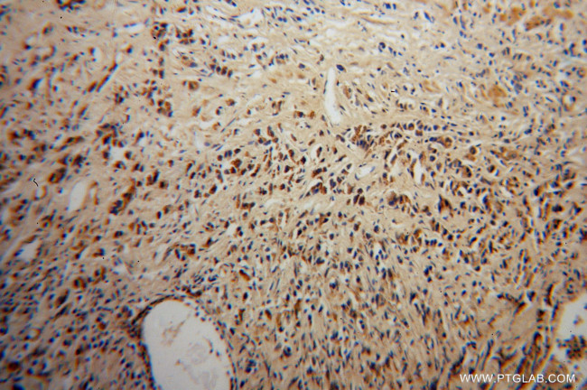 DOK4 Antibody in Immunohistochemistry (Paraffin) (IHC (P))