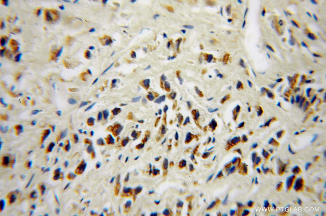 DOK4 Antibody in Immunohistochemistry (Paraffin) (IHC (P))