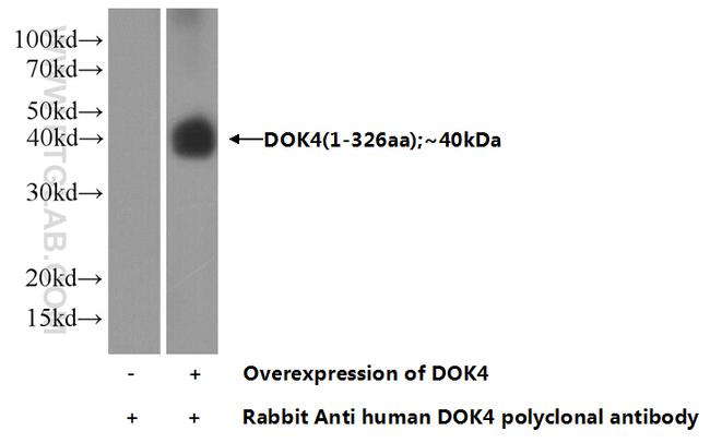 DOK4 Antibody in Western Blot (WB)