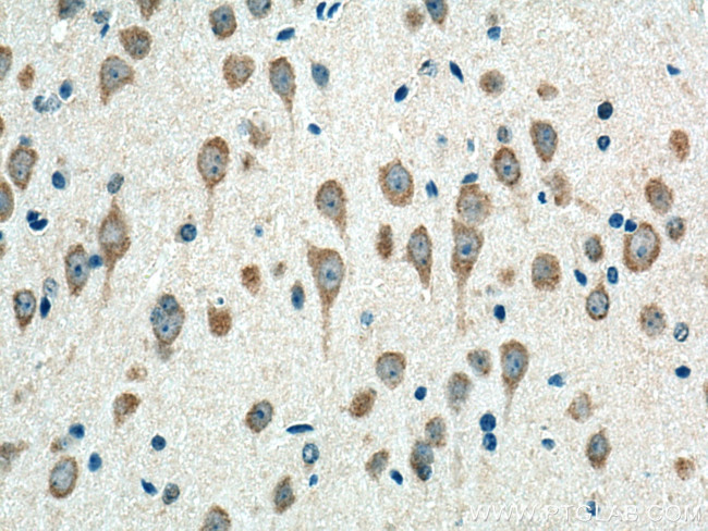 alpha-SNAP Antibody in Immunohistochemistry (Paraffin) (IHC (P))