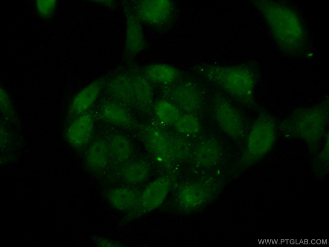 CSNK2A2 Antibody in Immunocytochemistry (ICC/IF)