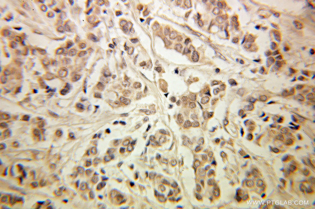 GSPT1 Antibody in Immunohistochemistry (Paraffin) (IHC (P))