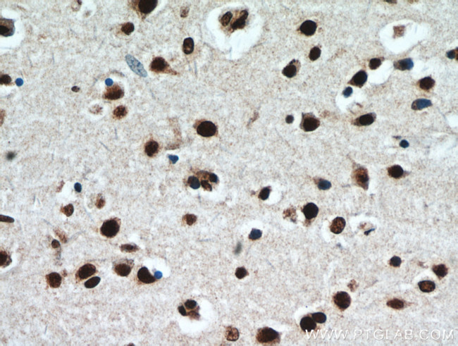 TDP-43 Antibody in Immunohistochemistry (Paraffin) (IHC (P))