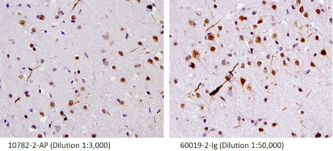 TDP-43 Antibody in Immunohistochemistry (Paraffin) (IHC (P))