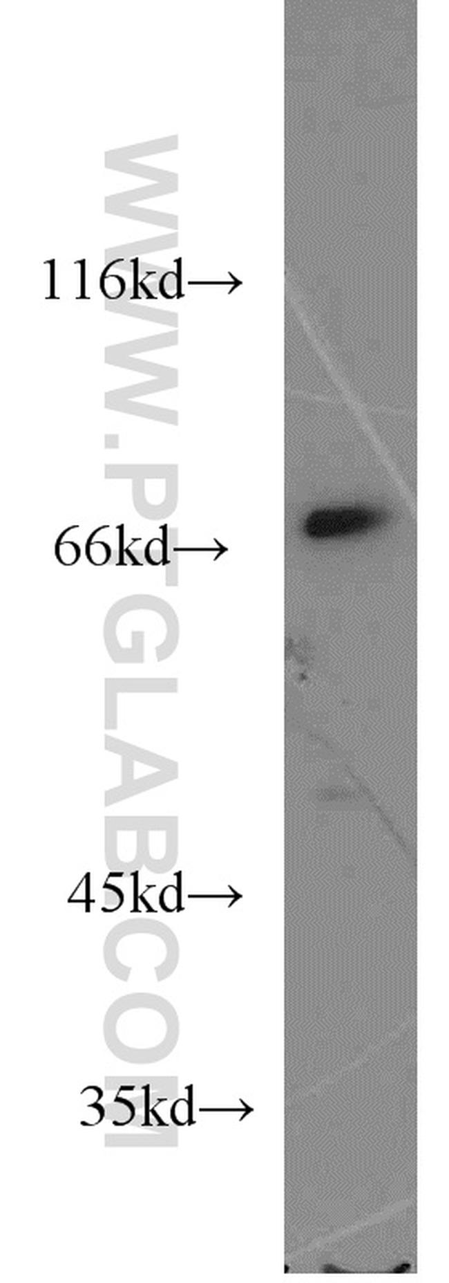 OPTN Antibody in Western Blot (WB)