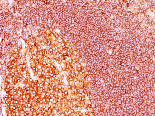 MALT1 (MALT-Lymphoma Marker) Antibody in Immunohistochemistry (Paraffin) (IHC (P))