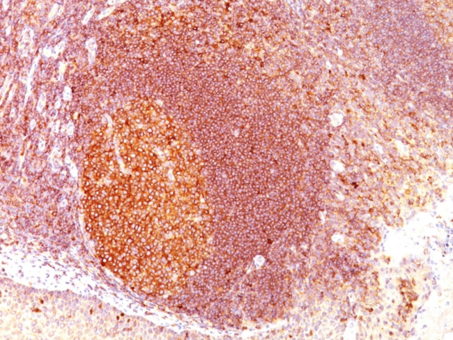 MALT1 (MALT-Lymphoma Marker) Antibody in Immunohistochemistry (Paraffin) (IHC (P))