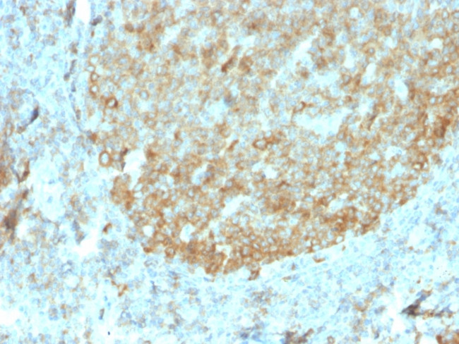 MALT1 Antibody in Immunohistochemistry (Paraffin) (IHC (P))