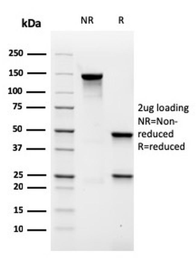 MALT1 Antibody in SDS-PAGE (SDS-PAGE)