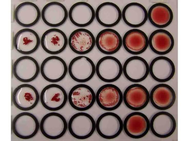 Red Blood Cell Antibody in Agglutination (AGG)