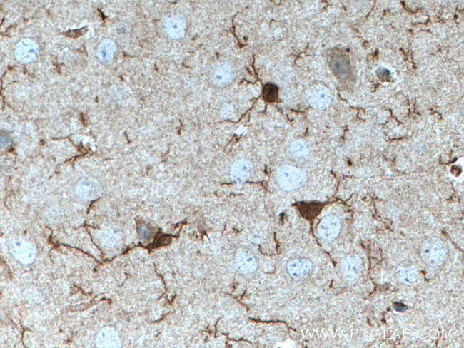 IBA1 Antibody in Immunohistochemistry (Paraffin) (IHC (P))