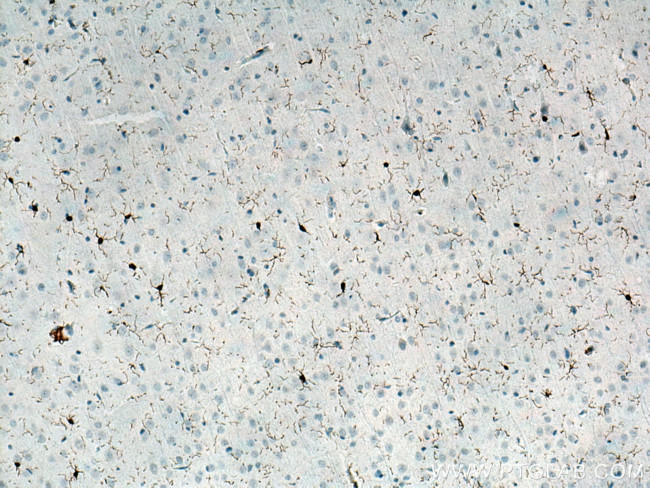 IBA1 Antibody in Immunohistochemistry (Paraffin) (IHC (P))