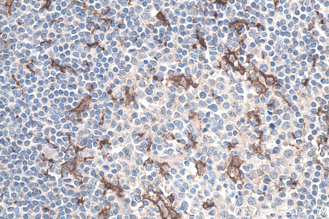 IBA1 Antibody in Immunohistochemistry (Paraffin) (IHC (P))