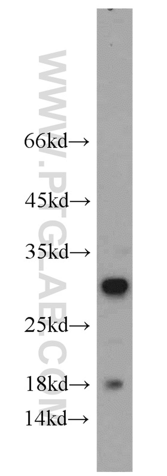 STXBP6 Antibody in Western Blot (WB)