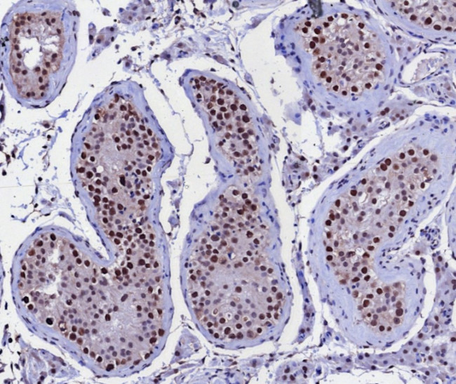 KIF2C (Kinesin Family Member 2C)/MCAK Antibody in Immunohistochemistry (Paraffin) (IHC (P))