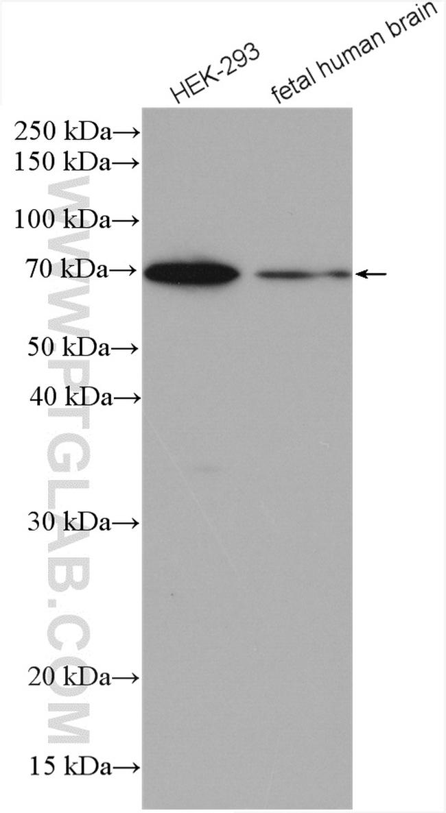 PGM2 Antibody in Western Blot (WB)