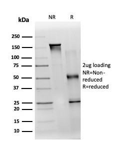 TDRKH Antibody in SDS-PAGE (SDS-PAGE)