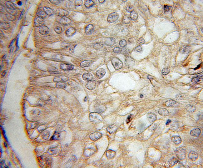 IL13RA2 Antibody in Immunohistochemistry (Paraffin) (IHC (P))