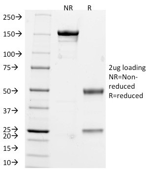 Chromogranin A/CHGA (Neuroendocrine Marker) Antibody in SDS-PAGE (SDS-PAGE)