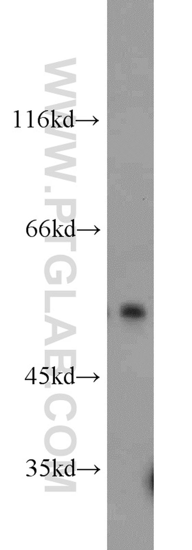 MUM1/IRF4 Antibody in Western Blot (WB)