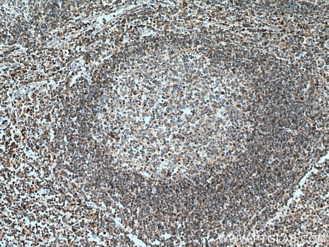 Integrin beta-7 Antibody in Immunohistochemistry (Paraffin) (IHC (P))