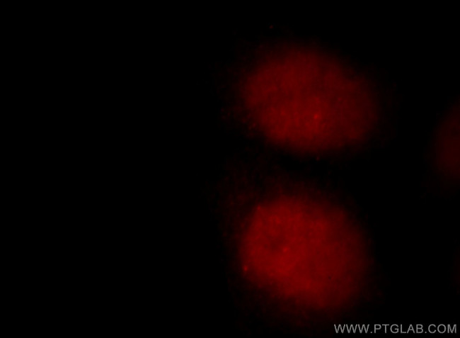 ZBTB7B Antibody in Immunocytochemistry (ICC/IF)