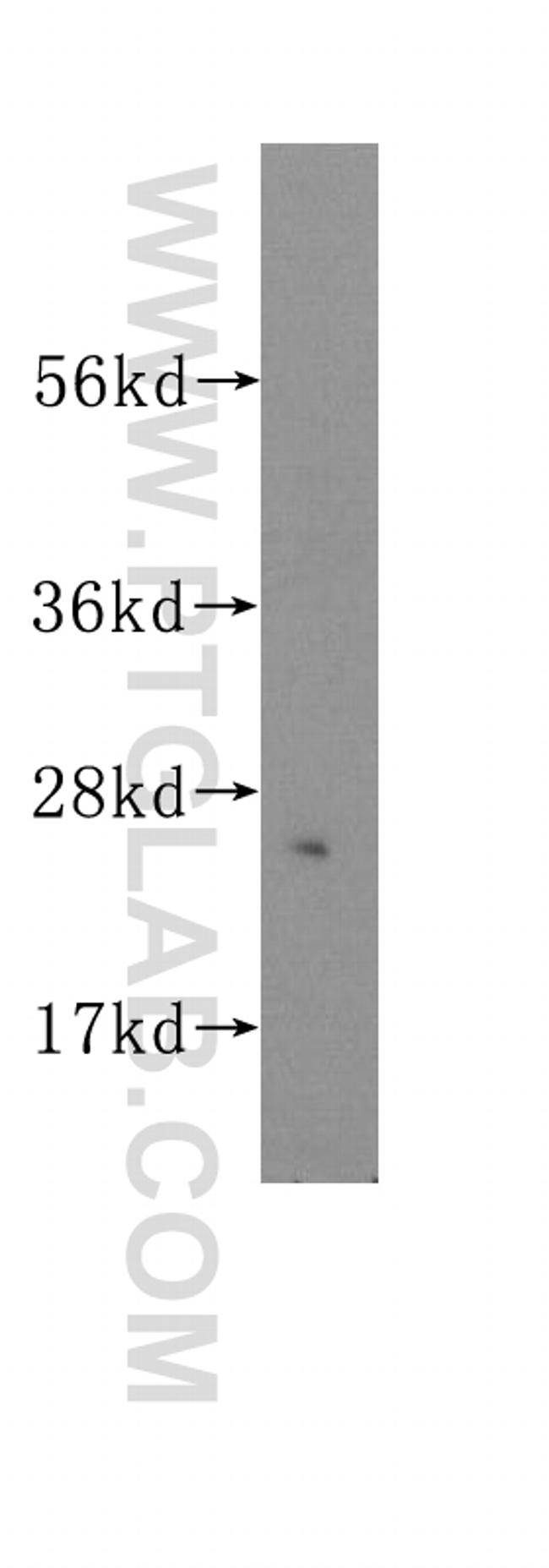 UMP/CMP kinase Antibody in Western Blot (WB)