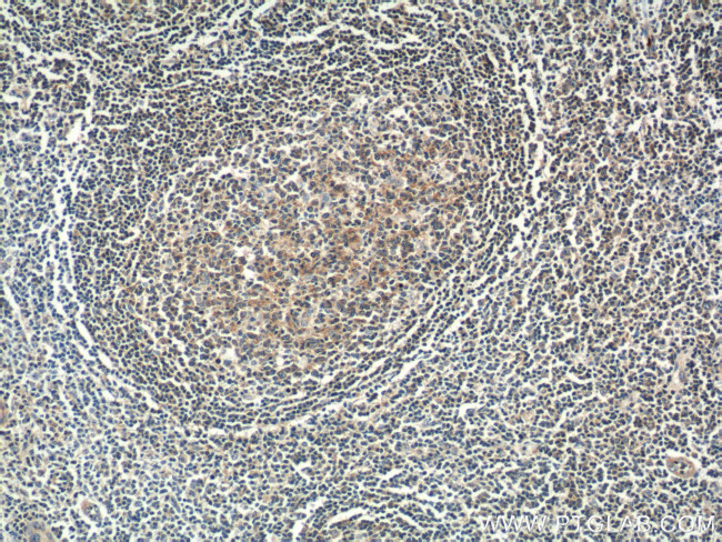 DEF6 Antibody in Immunohistochemistry (Paraffin) (IHC (P))