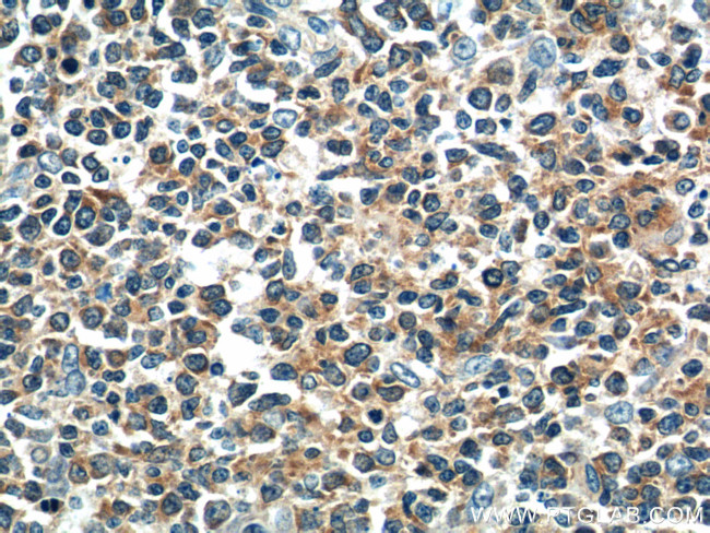 DEF6 Antibody in Immunohistochemistry (Paraffin) (IHC (P))