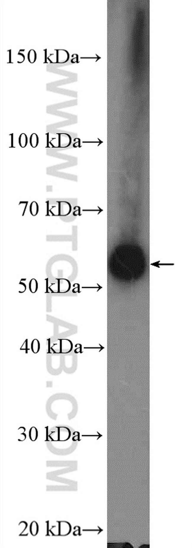 ARHGEF5 Antibody in Western Blot (WB)