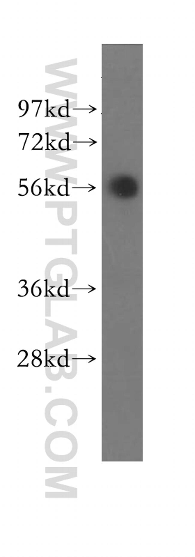 SLA/LP Antibody in Western Blot (WB)