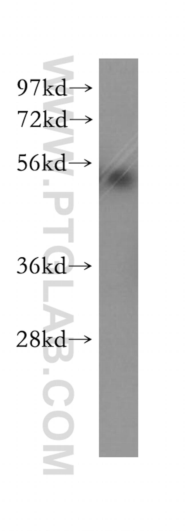 Cyclin E1 Antibody in Western Blot (WB)