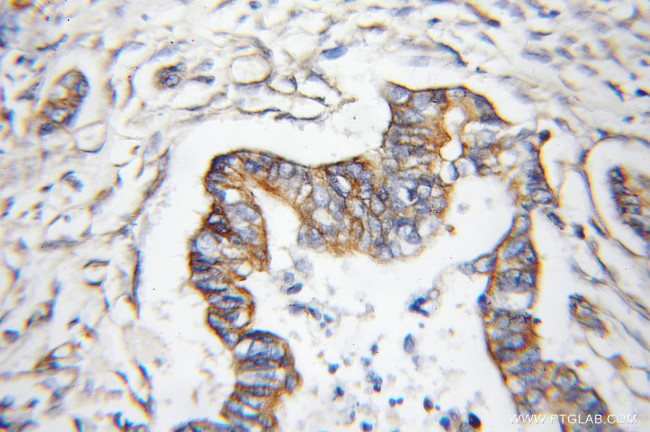 OGT Antibody in Immunohistochemistry (Paraffin) (IHC (P))