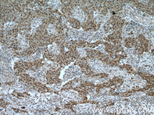 OGT Antibody in Immunohistochemistry (Paraffin) (IHC (P))