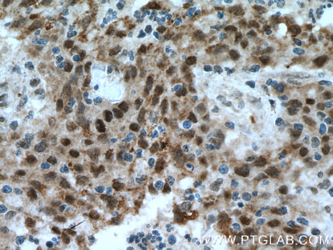 OGT Antibody in Immunohistochemistry (Paraffin) (IHC (P))