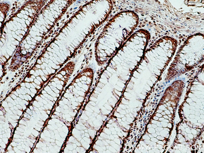 OGT Antibody in Immunohistochemistry (Paraffin) (IHC (P))