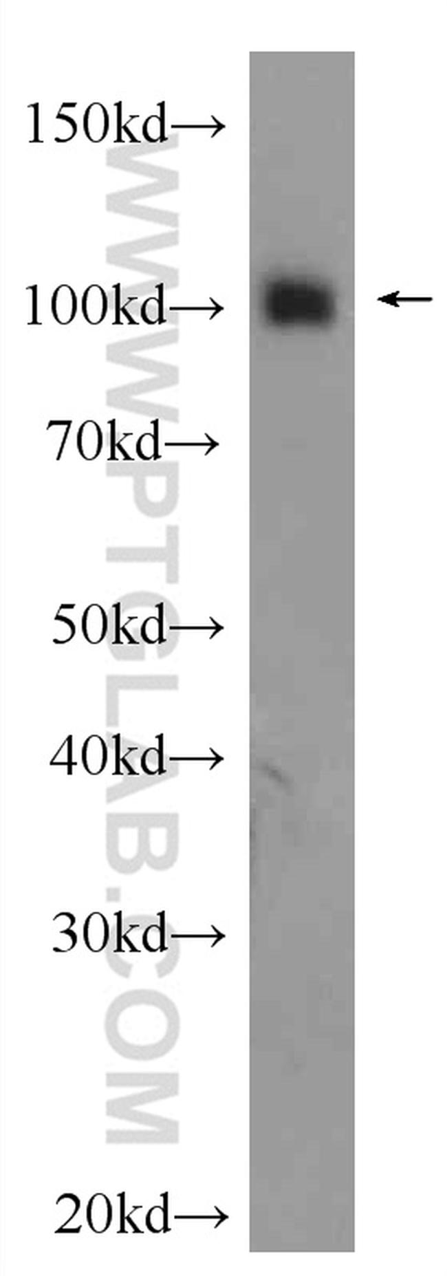 OGT Antibody in Western Blot (WB)