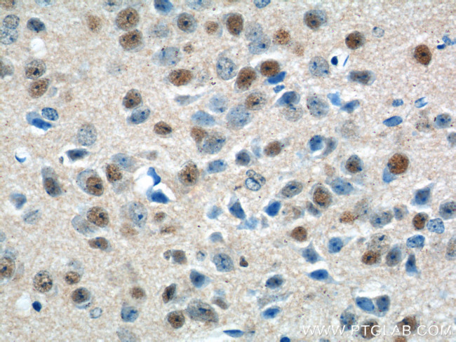 PNKD Antibody in Immunohistochemistry (Paraffin) (IHC (P))