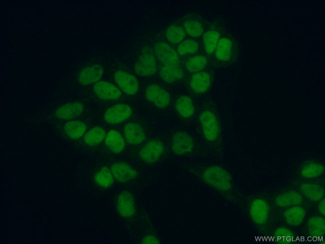 MCM5 Antibody in Immunocytochemistry (ICC/IF)