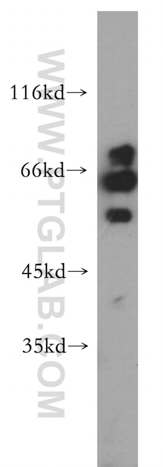 RAG2 Antibody in Western Blot (WB)