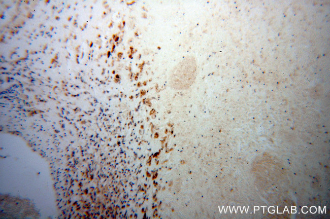 RSAD2 Antibody in Immunohistochemistry (Paraffin) (IHC (P))