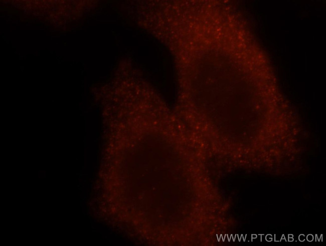 RSAD2 Antibody in Immunocytochemistry (ICC/IF)