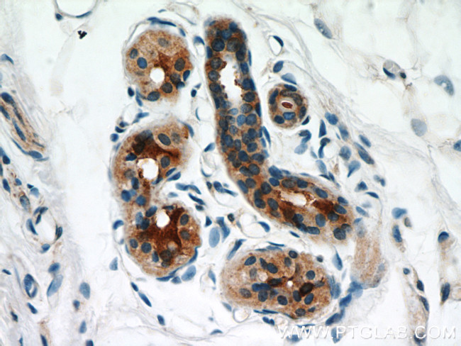 RSAD2 Antibody in Immunohistochemistry (Paraffin) (IHC (P))