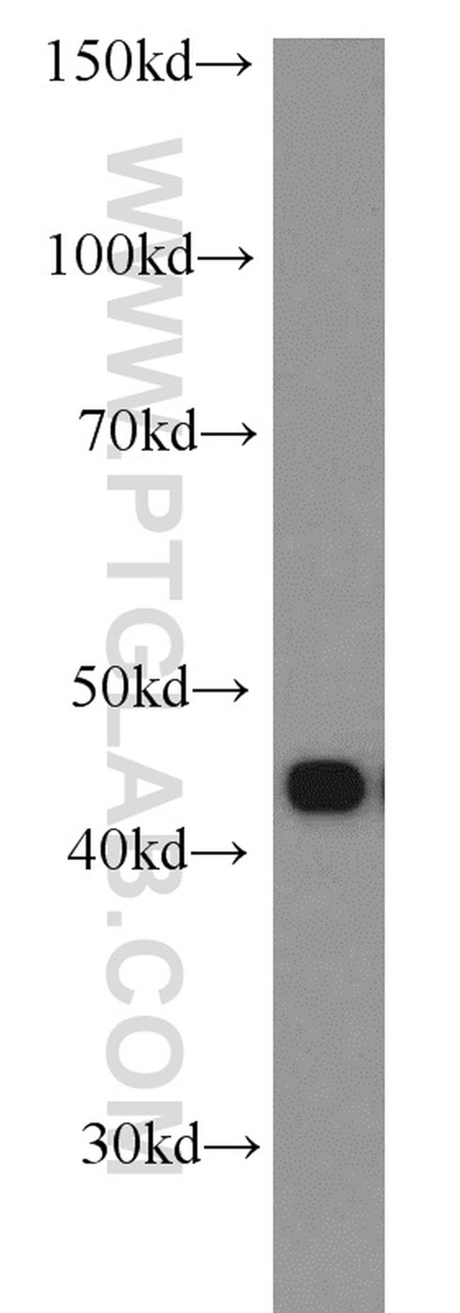 RSAD2 Antibody in Western Blot (WB)