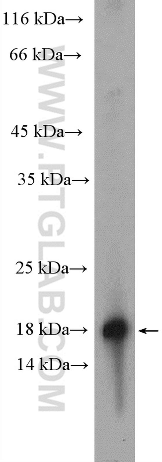 RBP5 Antibody in Western Blot (WB)