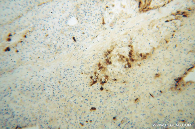 Apolipoprotein H Antibody in Immunohistochemistry (Paraffin) (IHC (P))